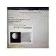 Shoulder array coil, for 1.5T Siemens Mri, 5516583